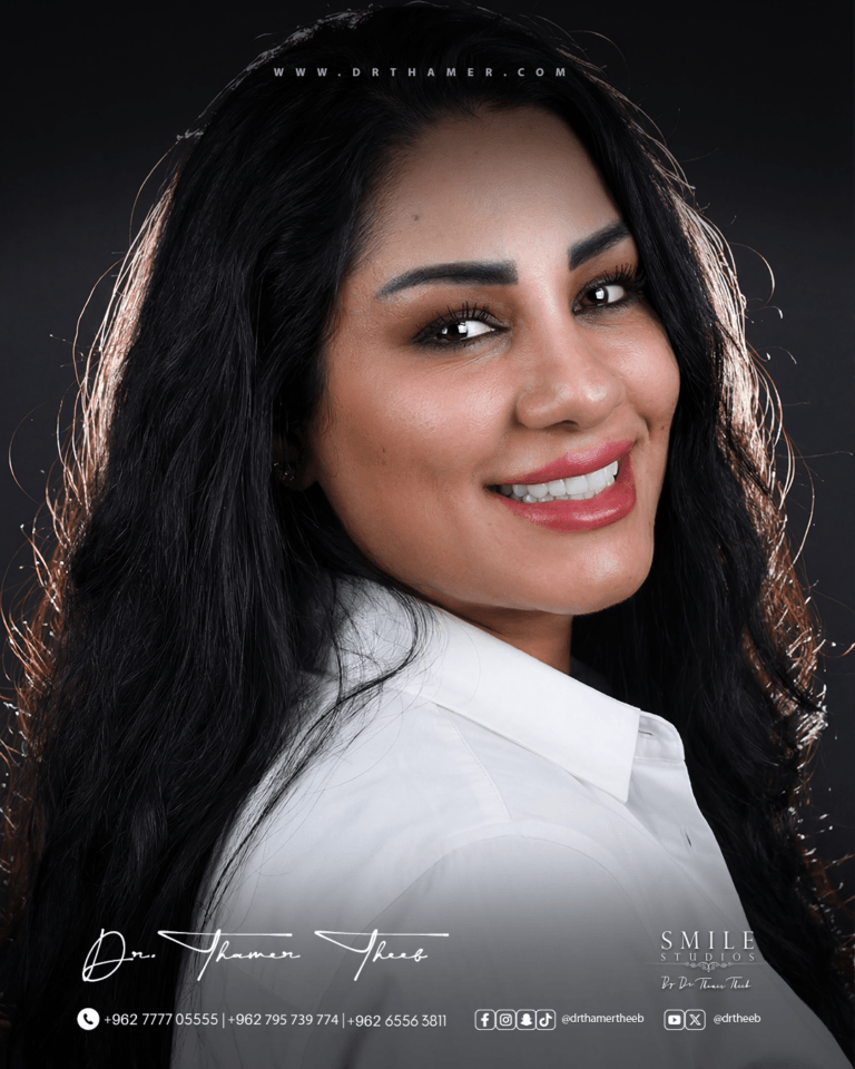 Hollywood Smile for Complex Cases: Why You Need a Prosthodontist