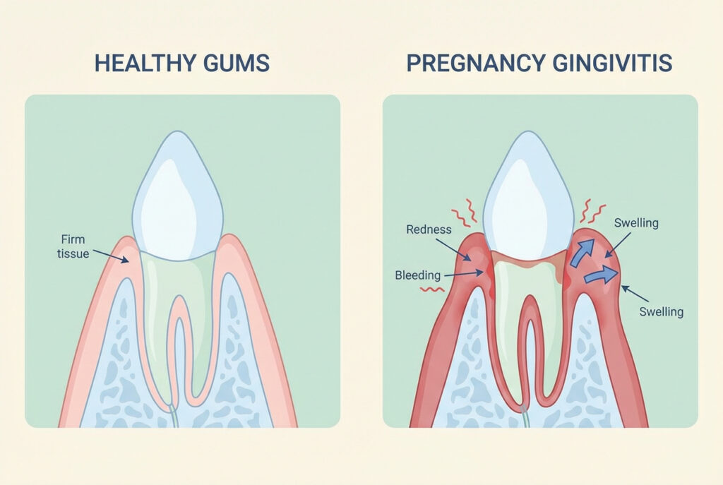 Dental Health During Pregnancy | Dr. Thamer's Clinics Guide